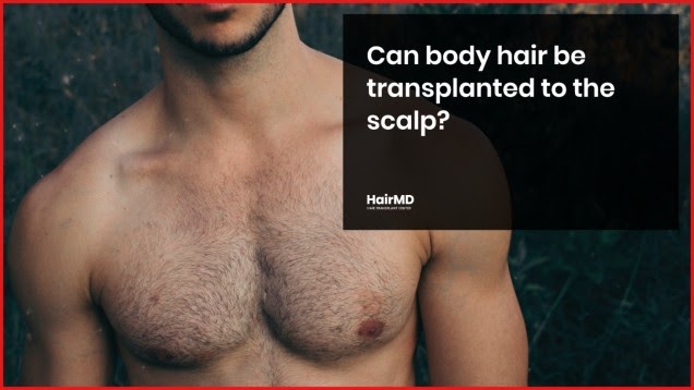 Is Body Hair to Scalp Transplant Possible? - hairmd