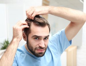 Does Minoxidil Work on the Hairline or Frontal Baldness? - hairmd