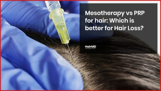 Mesotherapy vs PRP for hair: Which is better for Hair Loss? - hairmd