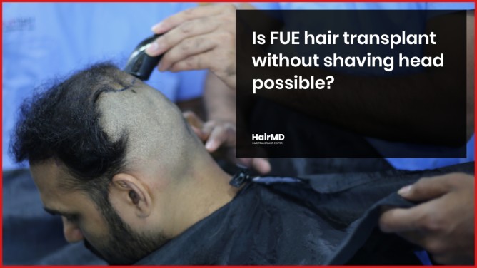 Is FUE Hair Transplant Without Shaving Head Possible?