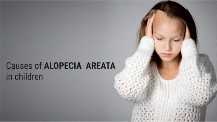 Alopecia Areata in Children: What Causes Hair Fall in Kids? - hairmd
