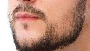 How to fix a patchy beard? - hairmd