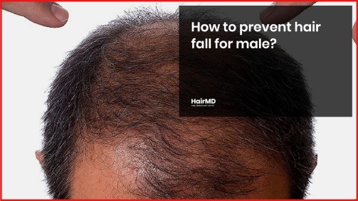 How to prevent hair fall for male? - hairmd