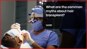 5 Common Myths and Their Actual Facts About Hair Transplant - hairmd