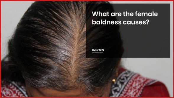 Hair Loss Treatment for Women Causes - Rejuvenate Hair