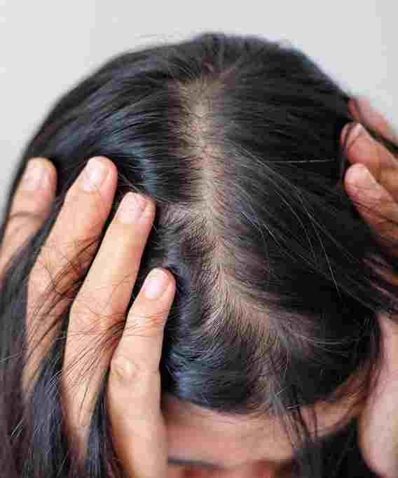 Why Is My Hair Falling Out? 8 Triggers Of Female Hair Loss