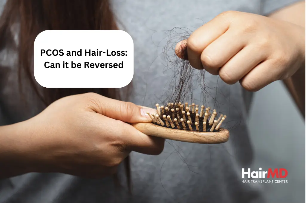 PCOS Hair Loss and Thinning: Causes, Treatments and Remedies – Equi Botanics