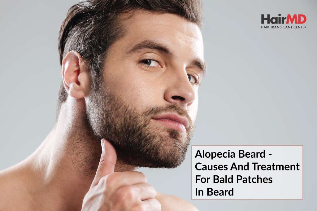 Alopecia Beard - Causes and Treatment for Bald Patches in Beard