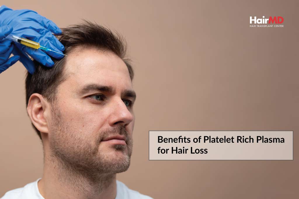 PRP Treatment for Hair Loss | Hair Restoration Orange County
