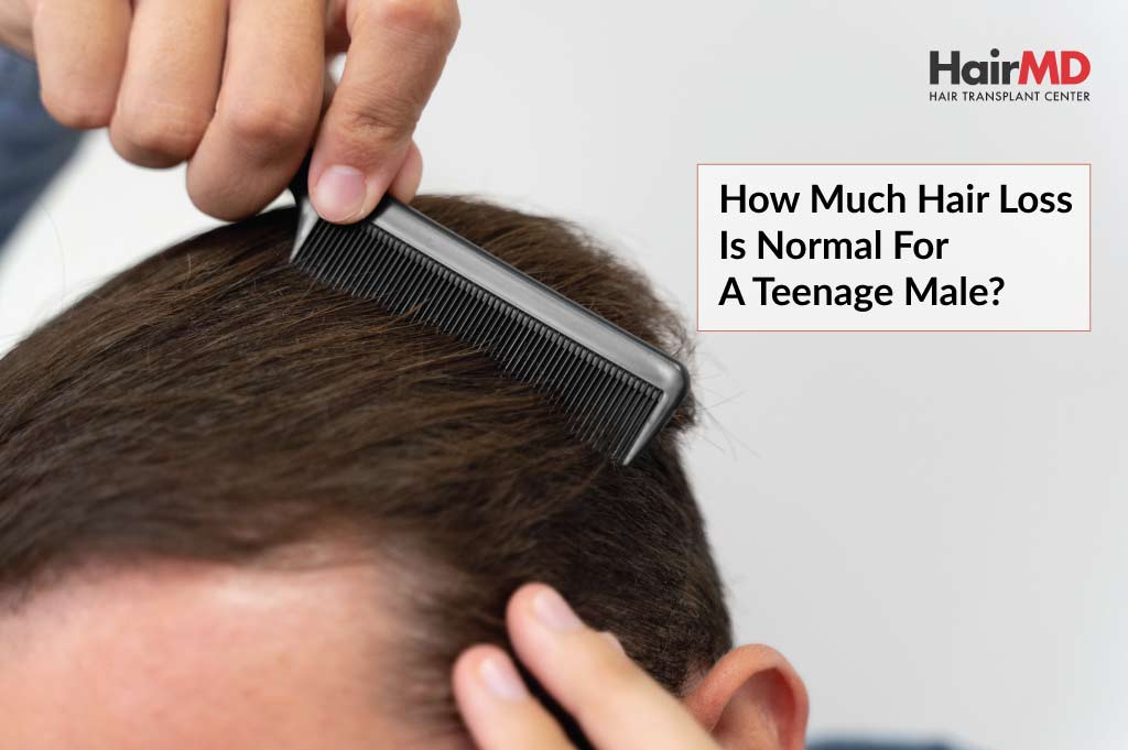 How Much Hair Loss is Normal for a Teenage Male?