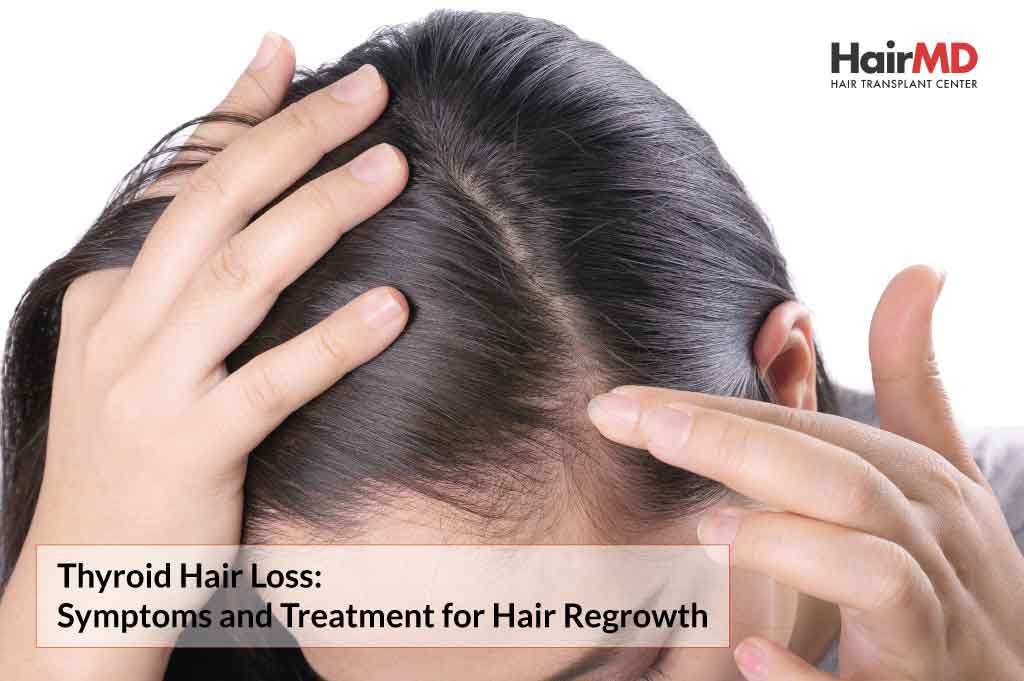 Thyroid Hair Loss: Symptoms and Treatment for Hair Regrowth