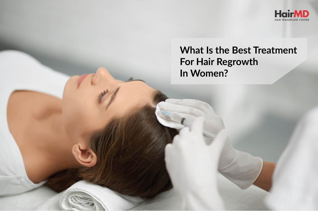 What is the Best Treatment for Hair Regrowth in Women?