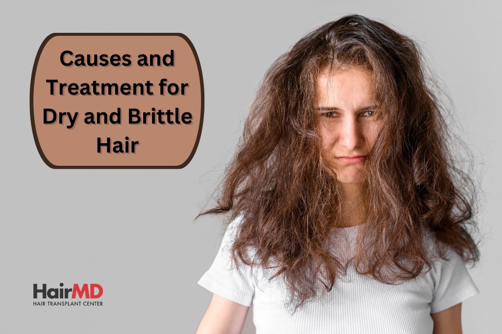 Dry hair is hair that does not have enough moisture and oil to maintain its  normal sheen and texture. Malnutrition, hypoparathyroidism , hypothyroidism  and other hormonal abnormalities is also leads to dry