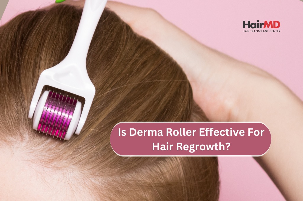 Is Derma Roller Effective for Hair Regrowth?
