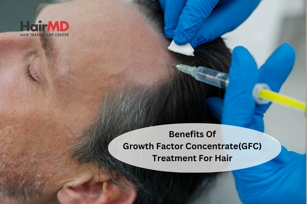 Benefits of Growth Factor Concentrate (GFC) Treatment for Hair