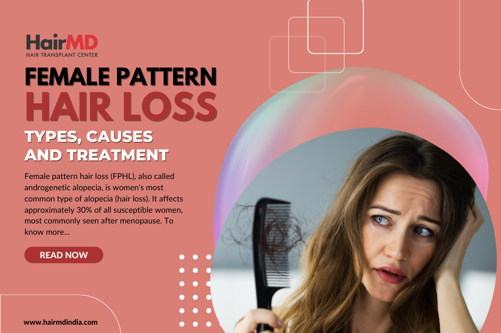 Hair Loss Treatment Woman: Female hair loss | LloydsPharmacy