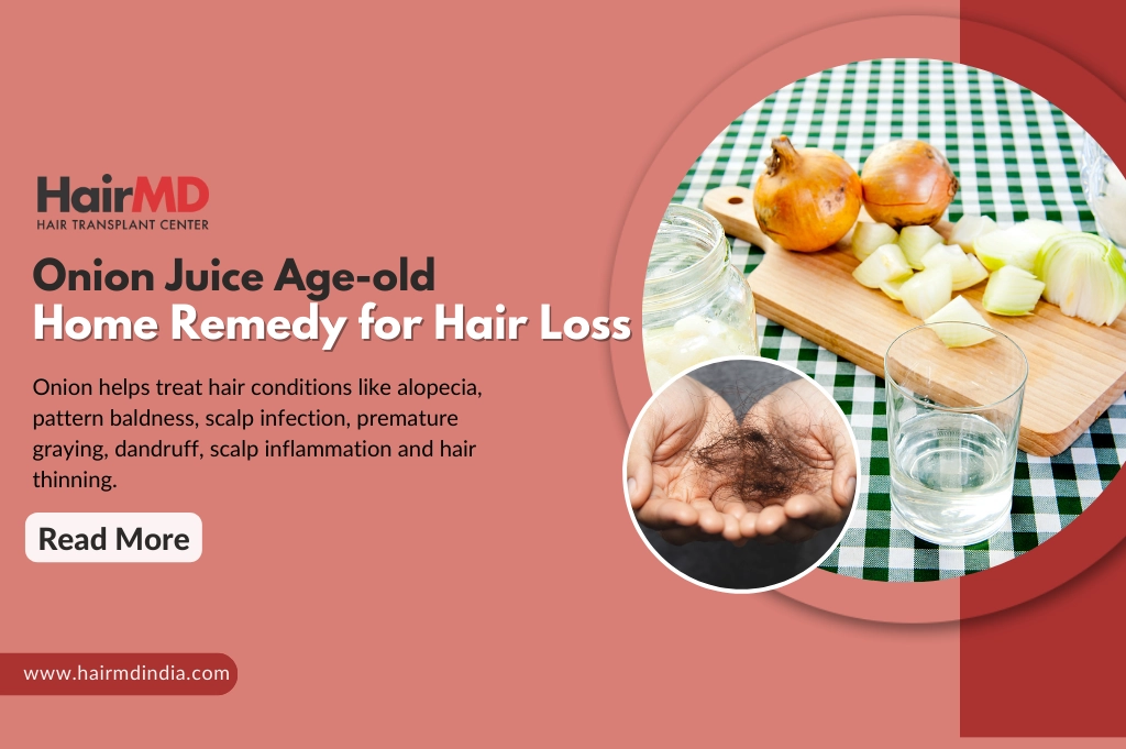 Onion Hair oil for hair fall & dandruff – Tru Hair and Skin
