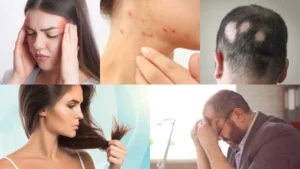 sensitive scalp