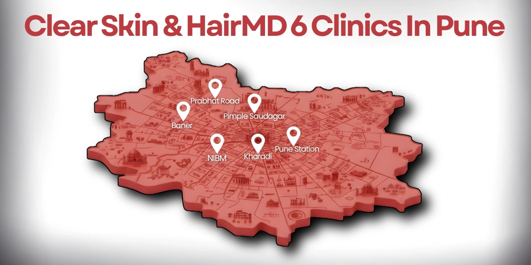 Clear Skin & HairMD Clinics In Pune