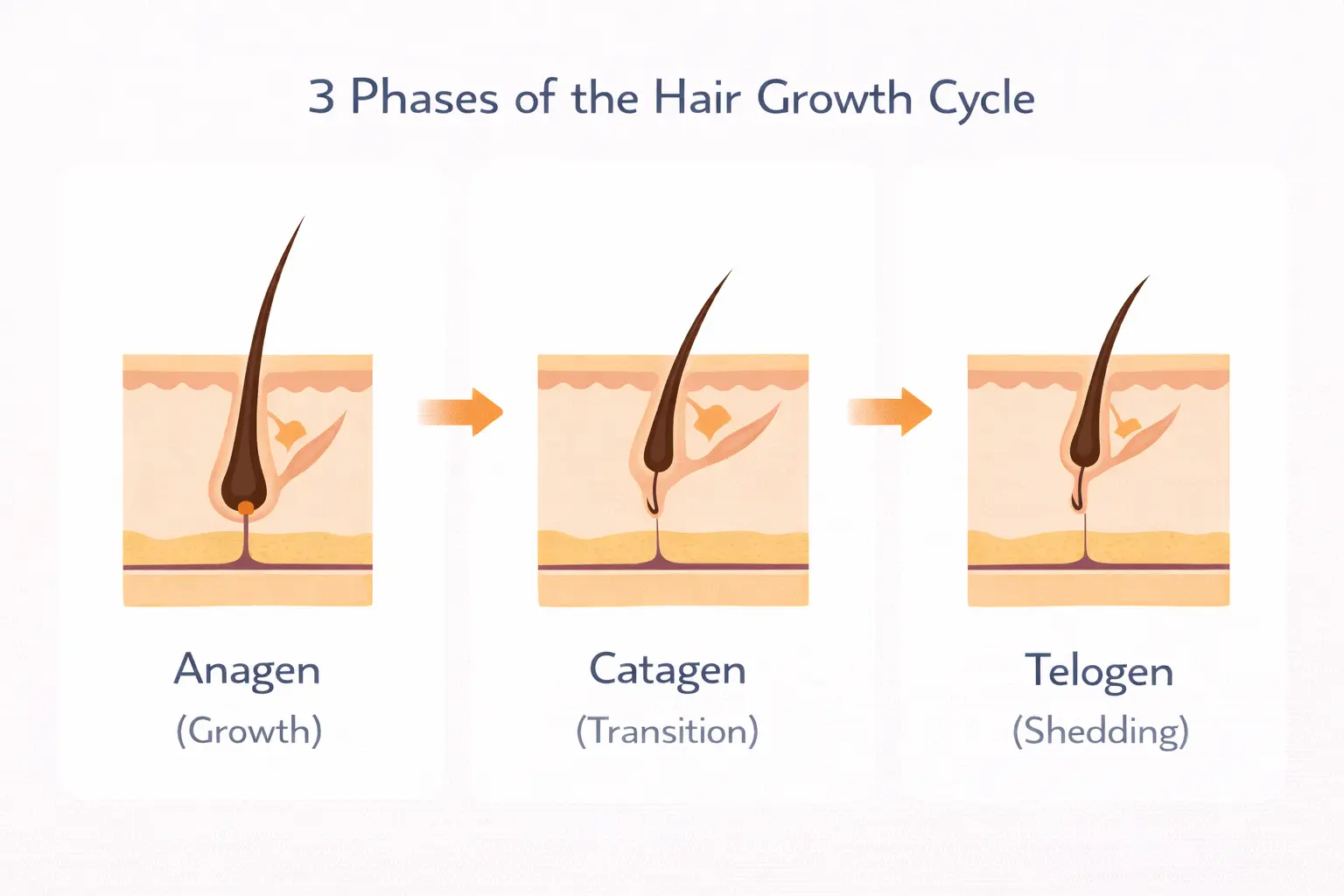 Normal hair growth cycle diagram showing anagen catagen telogen phases - HairMD Pune