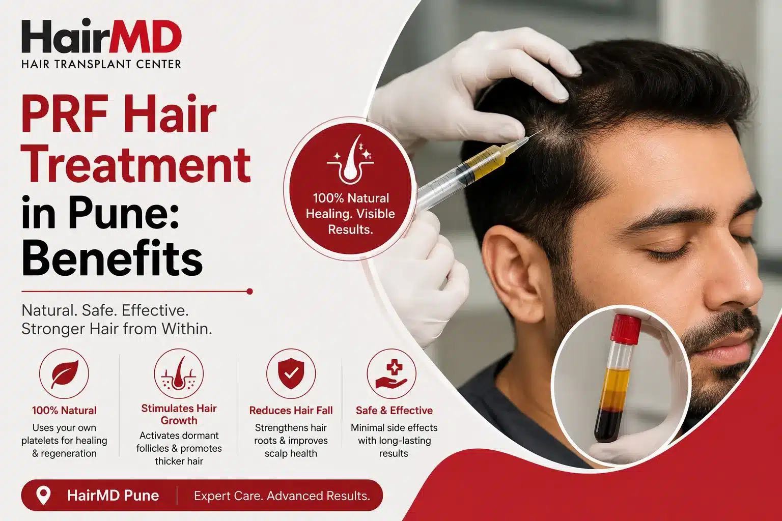 PRF Hair Treatment in Pune